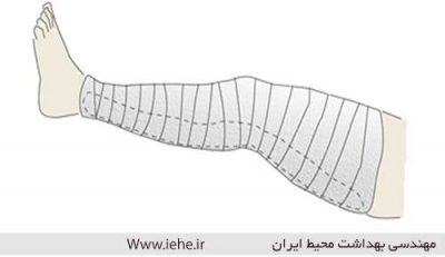 پاورپوینت پرستاری ارتوپدی