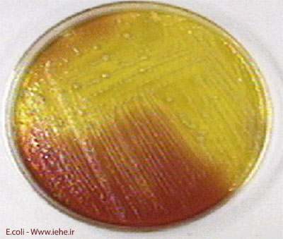 باکتری اشرشیاکلی E.coli