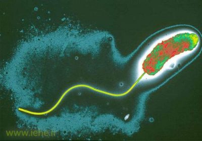 باکتری ویبریو کلرا عامل بیماری وبا Vibrio cholerae