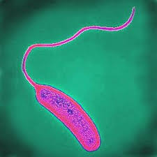 راهنمای کنترل ویبریوکلرا (Vibriocholerae) درآب آشامیدنی