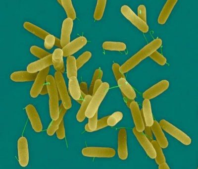 سودوموناس آئروژینوزا PSEUDOMONAS AERUGINOSA محیط کشت سودوموناس آئروژینوزا