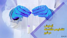 آزمایش تشخیص نشاسته در شیر