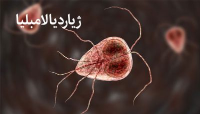 همه چیز درباره ژیاردیا لامبلیا - چرخه زندگی، علائم و را ه های پیشگیری از ژیاردیازیس