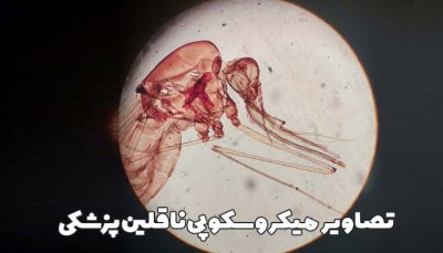 دانلود تصاویر زیر میکروسکوپی حشرات و ناقلین پزشکی مهم - PDF