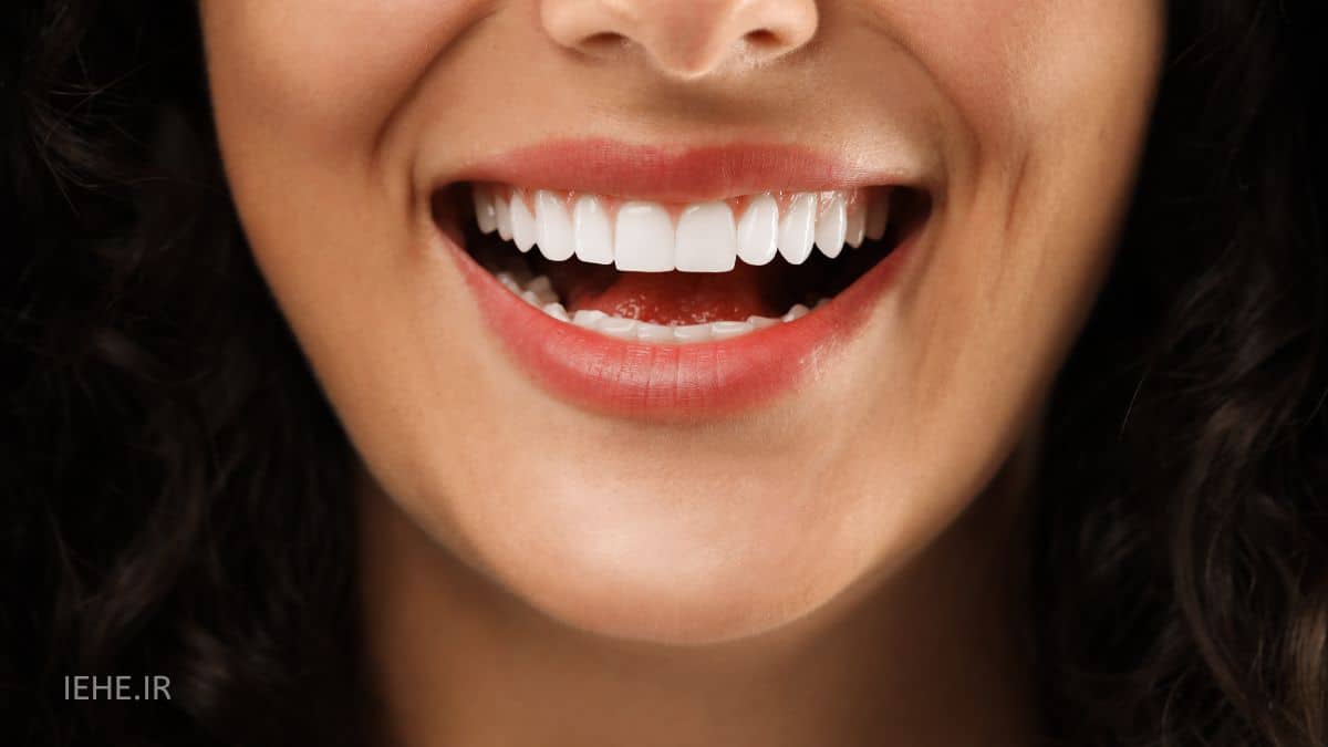 دندانپزشکی زیبایی و لبخند هالیوودی سلبریتی 