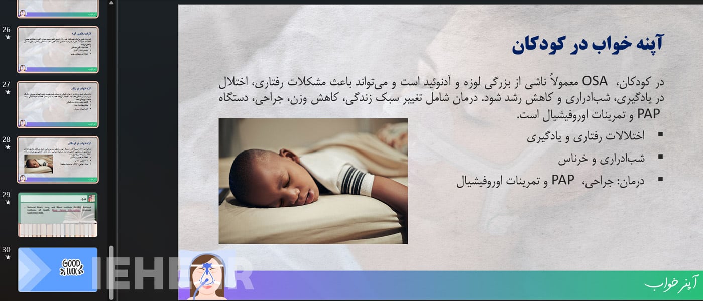 پاورپوینت آپنه خواب در کودکان دانلود