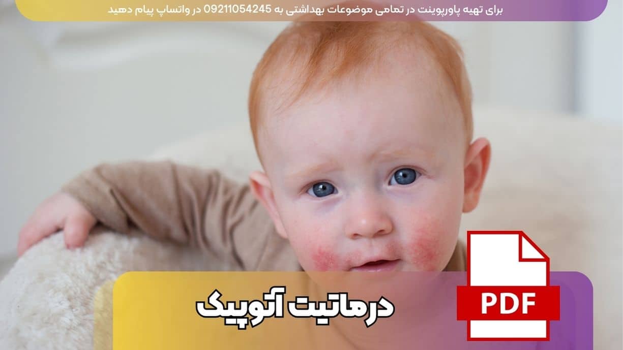 دانلود پاورپوینت درماتیت آتوپیک (اگزمای آتوپیک) با 48 اسلاید فارسی