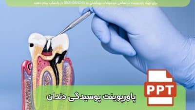 دانلود پاورپوینت پوسیدگی دندان و روش های پیشگیری و درمان با 16 اسلاید