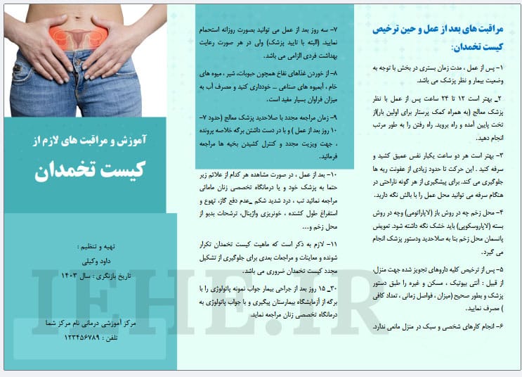 پمفلت کیست تخمدان
