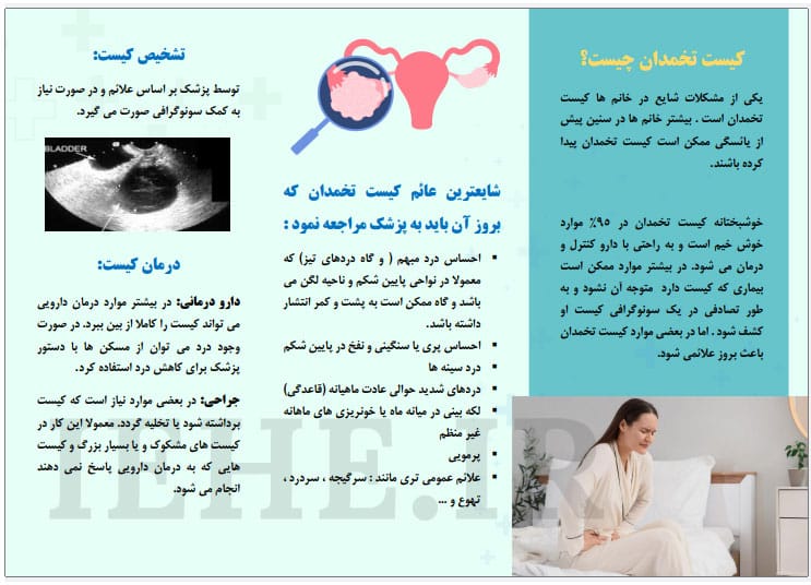 پمفلت کیست تخمدان